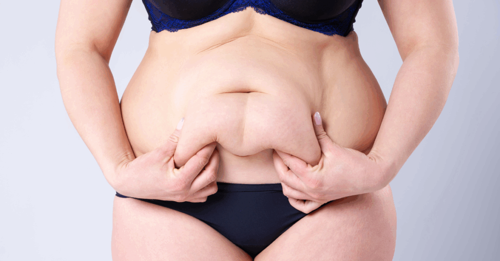woman deciding to get a second weight loss surgery