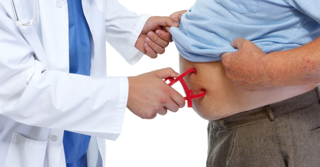 Gastric Sleeve effectiveness