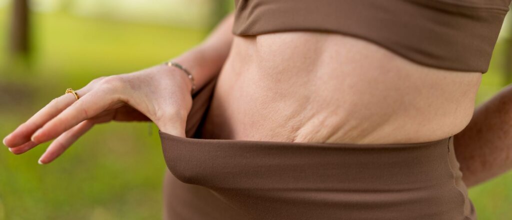 remove excess skin 